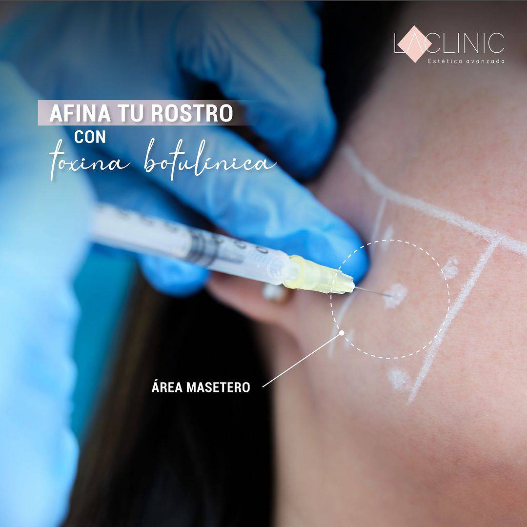 Botox Arrugas Faciales